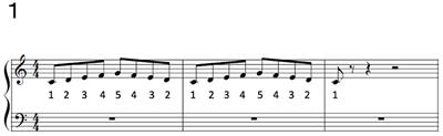 Impaired feedforward control of movements in pianists with focal dystonia